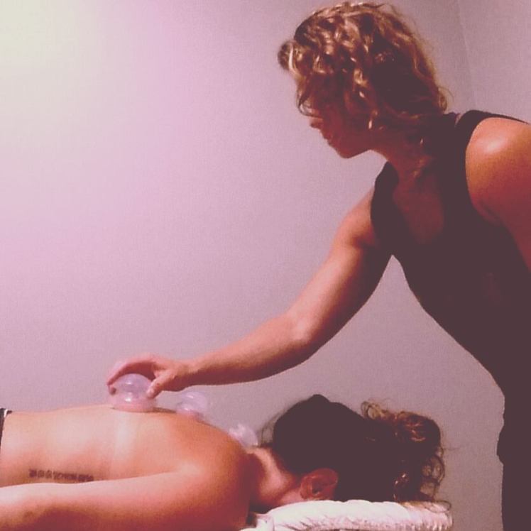 cupping